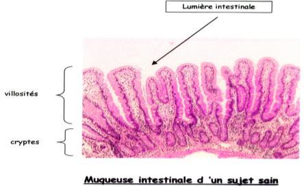 Muqueuse intestinale d'un sujet sain